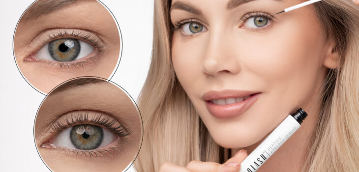 bester wimpernserum nanolash